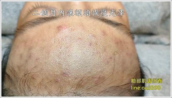 額頭編輯後.jpg
