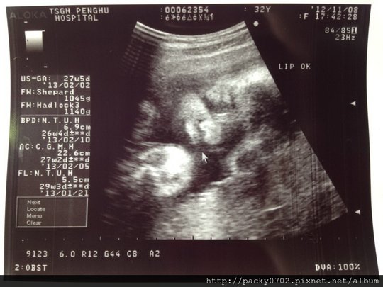 20121108