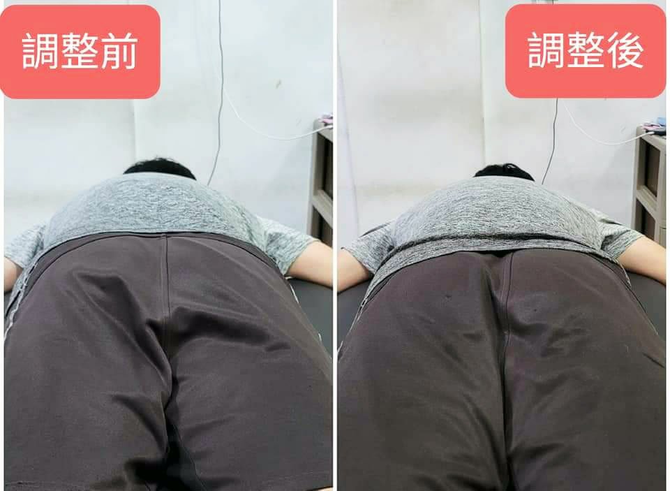【台南整復/整骨】元強健康手護會館｜駝背怎麼辦？脊椎歪了病痛