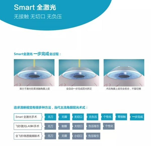 台北眼科醫師推薦ptt