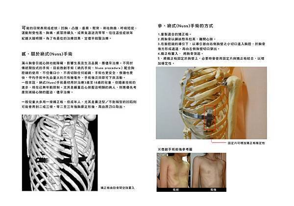 漏斗胸手冊3.jpg