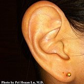 Ear Piercing