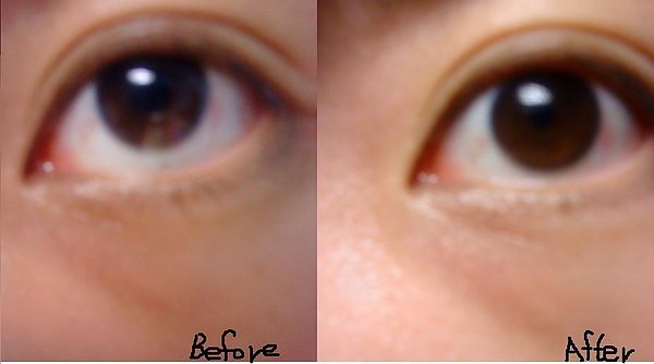 b&amp;a.JPG