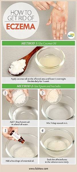 How-to-Get-Rid-of-Eczema-Cure-that-Works.jpg