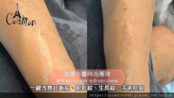 卡蔓台中SOBER SKIN.mpg_20220816_161805.054.jpg