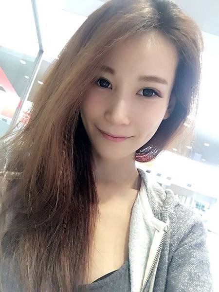 伊蓮絲術後（夫妻宮、臉頰、法令紋、下巴）_6700.jpg