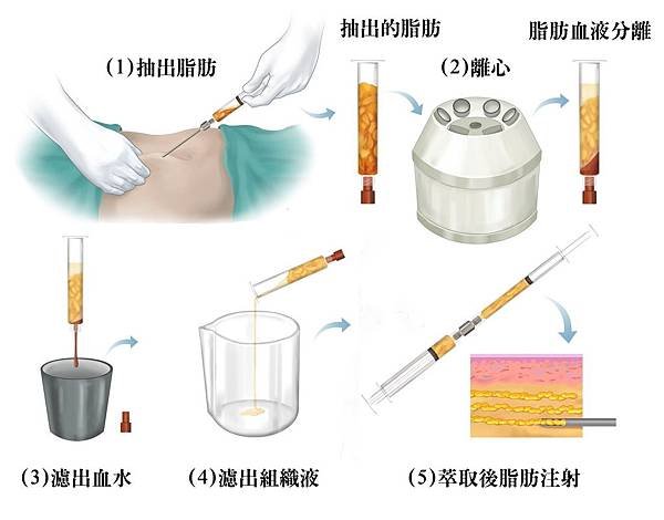 05台灣台北台中台南高雄抽脂權威醫師醫生推薦