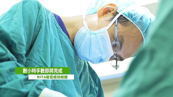 台灣鼻王吳孟穎隆鼻手術權威吳孟穎三段式結構式隆鼻手術.jpg