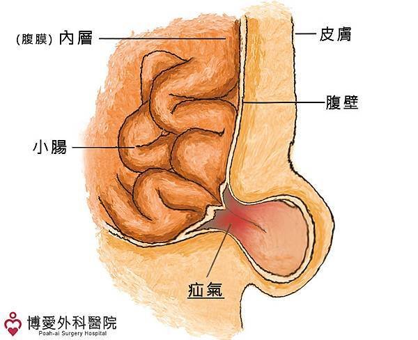 博愛疝氣專科醫院.jpg