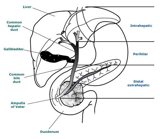 Classification_biliary