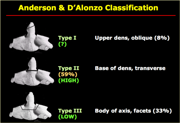 Odontoid Fracture