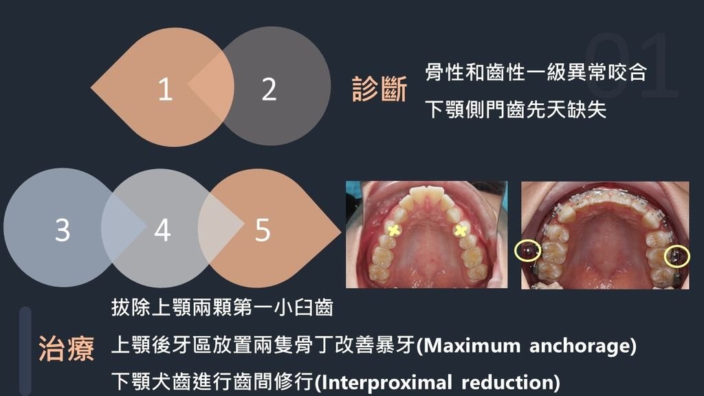 投影片4.JPG