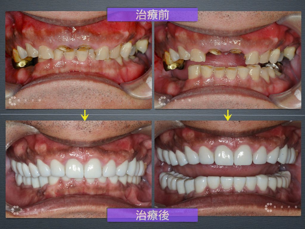 0600713楊宗翰 網路行銷用.006.jpeg