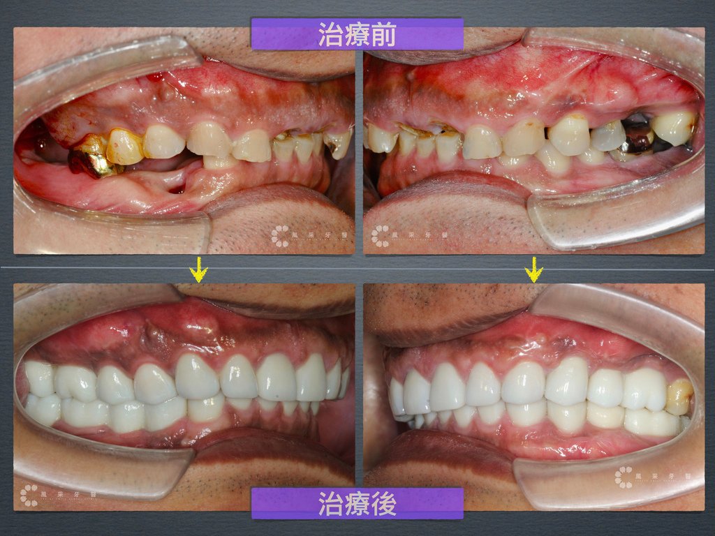 0600713楊宗翰 網路行銷用.008.jpeg