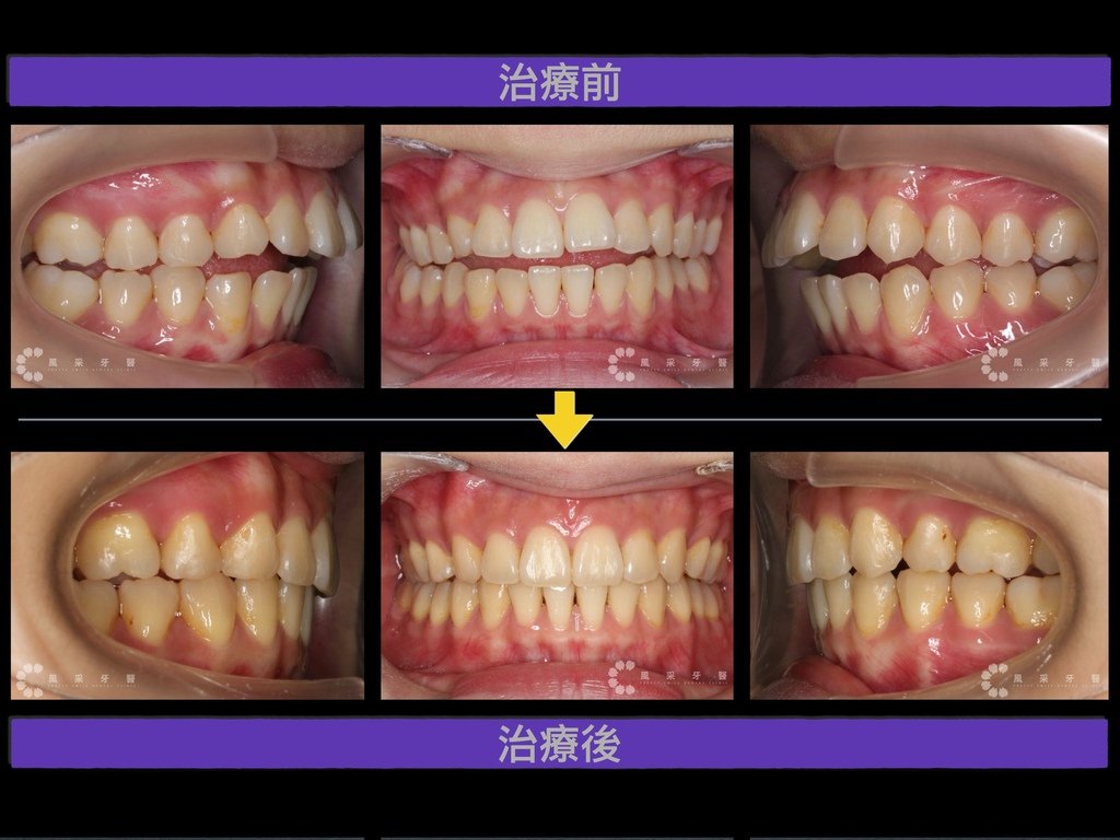 0900202蔡梓彤 keynote 網路行銷用.015.jpeg
