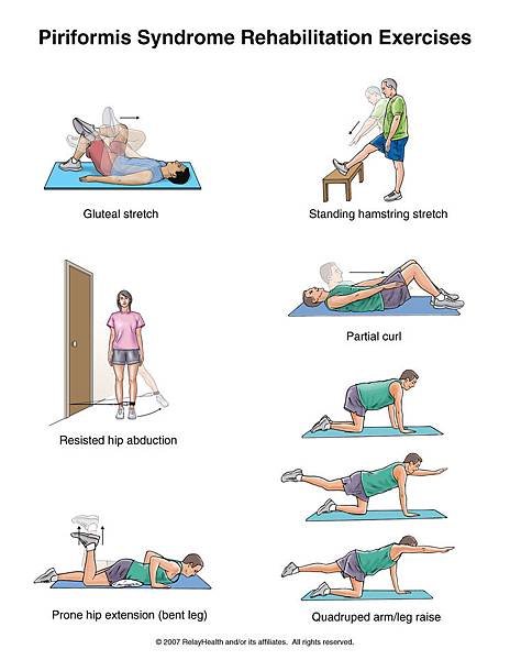 Piriformis Syndrome