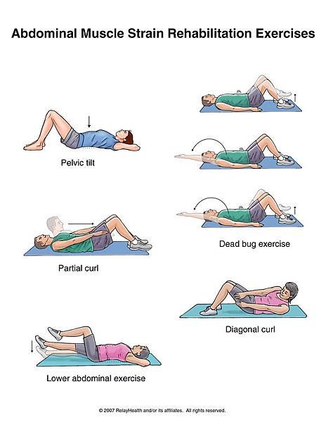 abdominal m. strain