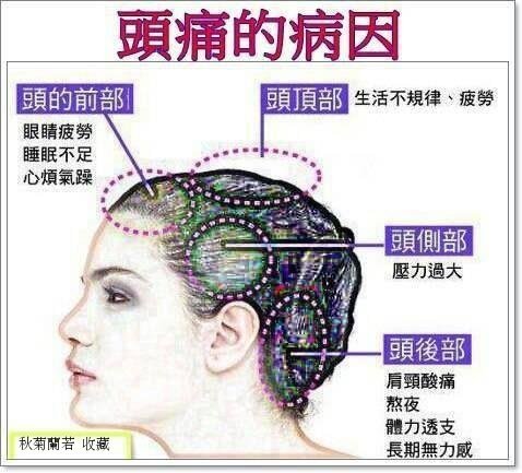 頭痛的病因20130531