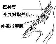 媽媽手、網球肘