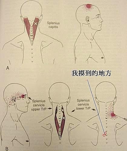 頭重昏沉，鬢邊閃閃叫2