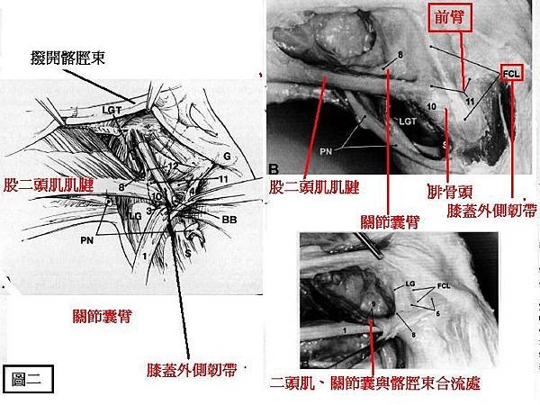 biceps femoris capsular arm