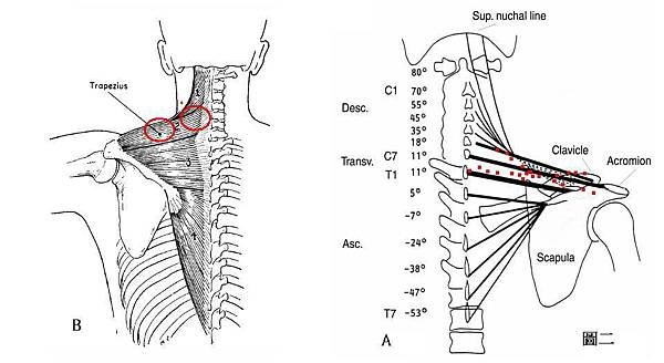 trapezius muscle