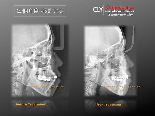 Chin Fan Page.138-001