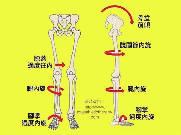 足醫，步態影響下肢排列，影響骨盆.jpg