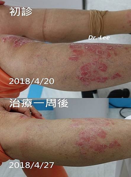 治療一周成效.jpg