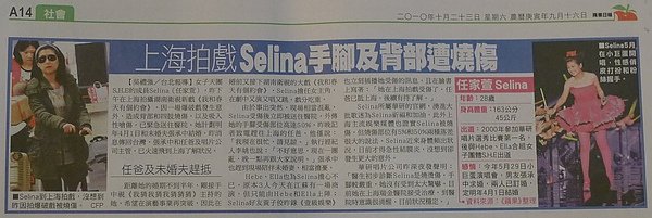 上海拍戲 Selina手腳及背部遭燒傷
