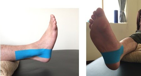 ankle  fixation taping 1.jpg