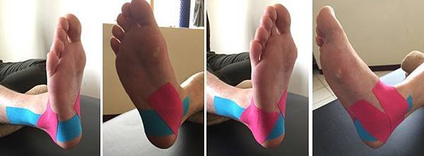 ankle  fixation taping 2.jpg