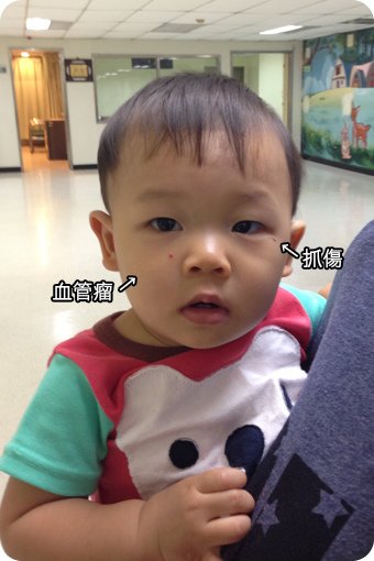 小宇滿1歲打德國麻疹疫苗-01.jpg
