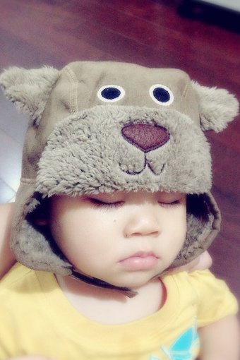 小宇1Y1M消失的血管瘤-05.jpg