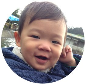 小宇1Y1M消失的血管瘤-06.jpg