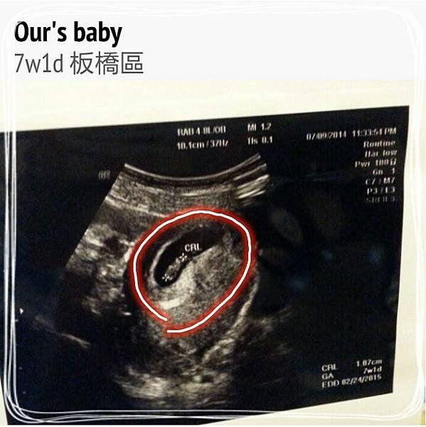 7W-1