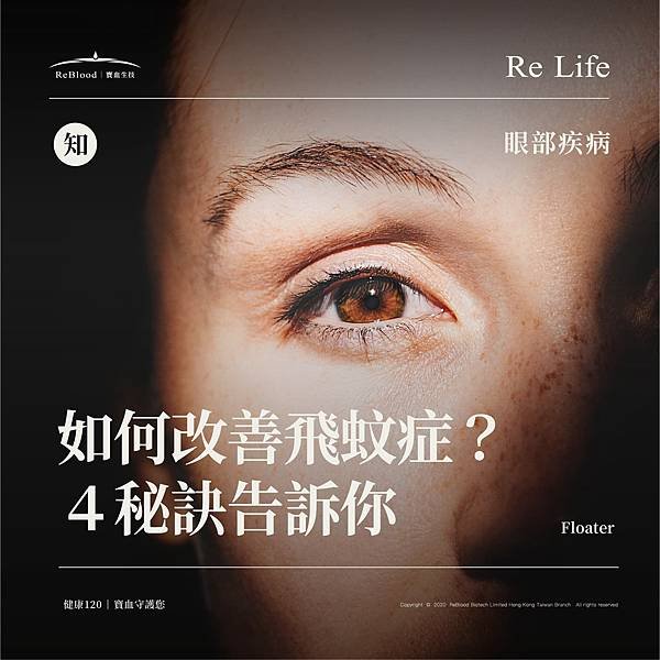 0106＿眼部疾病_工作區域 1 複本 2.jpg