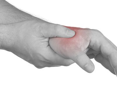 dequervains-tenosynovitis.jpg