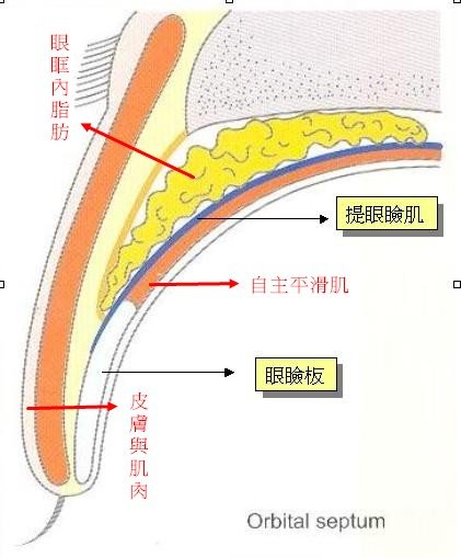 眼瞼1.jpg