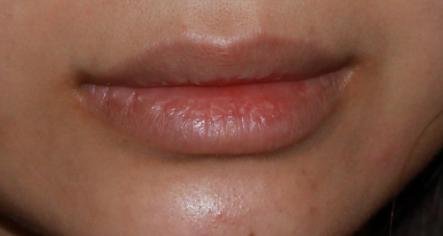 lip5
