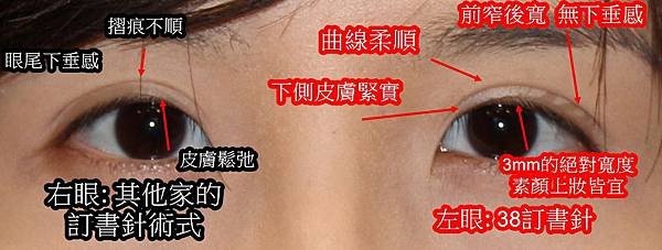 比較