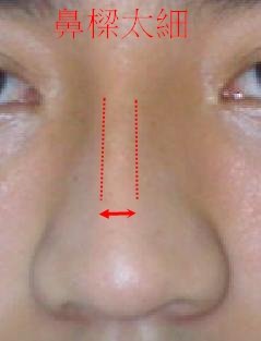 thin nose