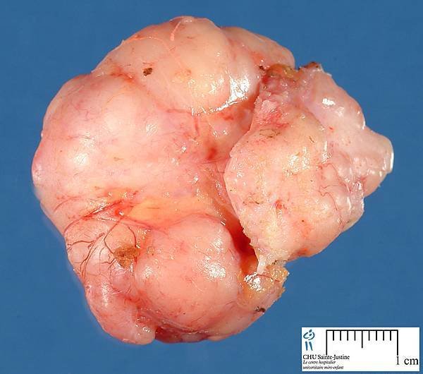 jpg_mammary_fibroadenoma_12_1a.jpg