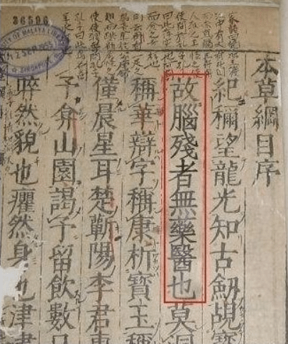 腦殘.png