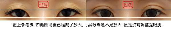 nonvivid eye1-3.jpg