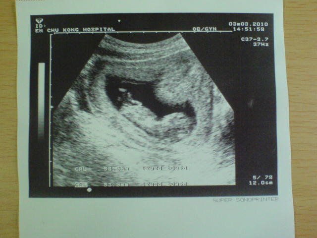 2010.03.03.JPG
