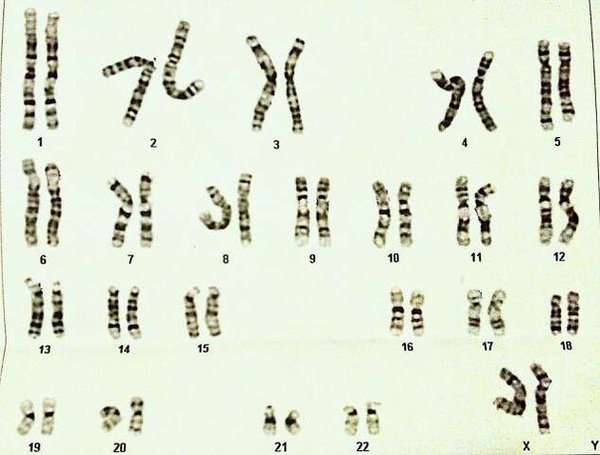 羊膜穿刺報告.jpg