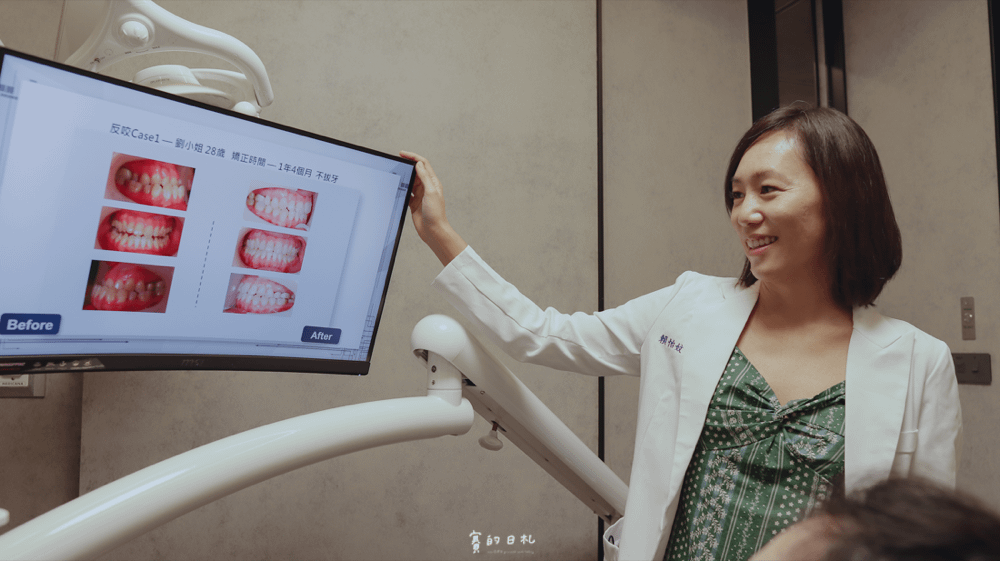 米羅牙醫 彰化牙醫 彰化隱適美 隱形牙套 牙套推薦 隱形矯正 牙齒矯正推薦 牙齒矯正諮詢 賽的日札-31.png