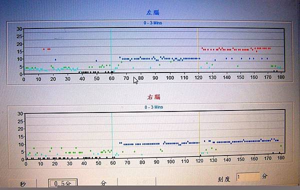 20121103有趣的腦波檢測