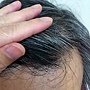 2011-0626-前面的頭髮長出來是黑的..